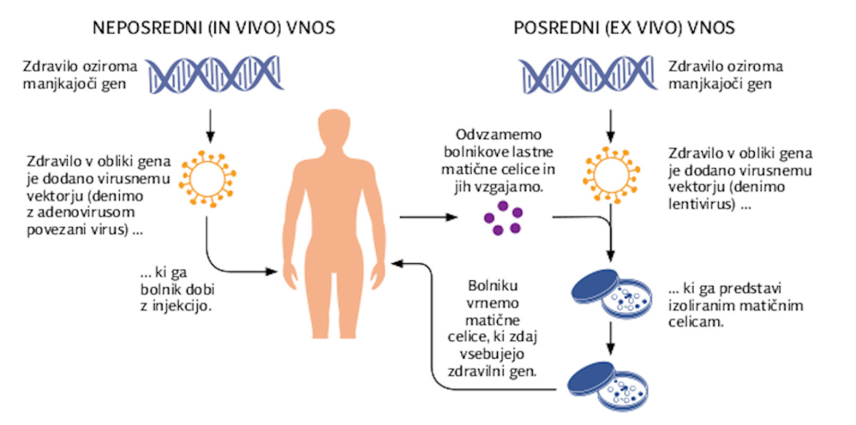 Gensko zdravljenje mukopolisaharidoz – naše izkušnje