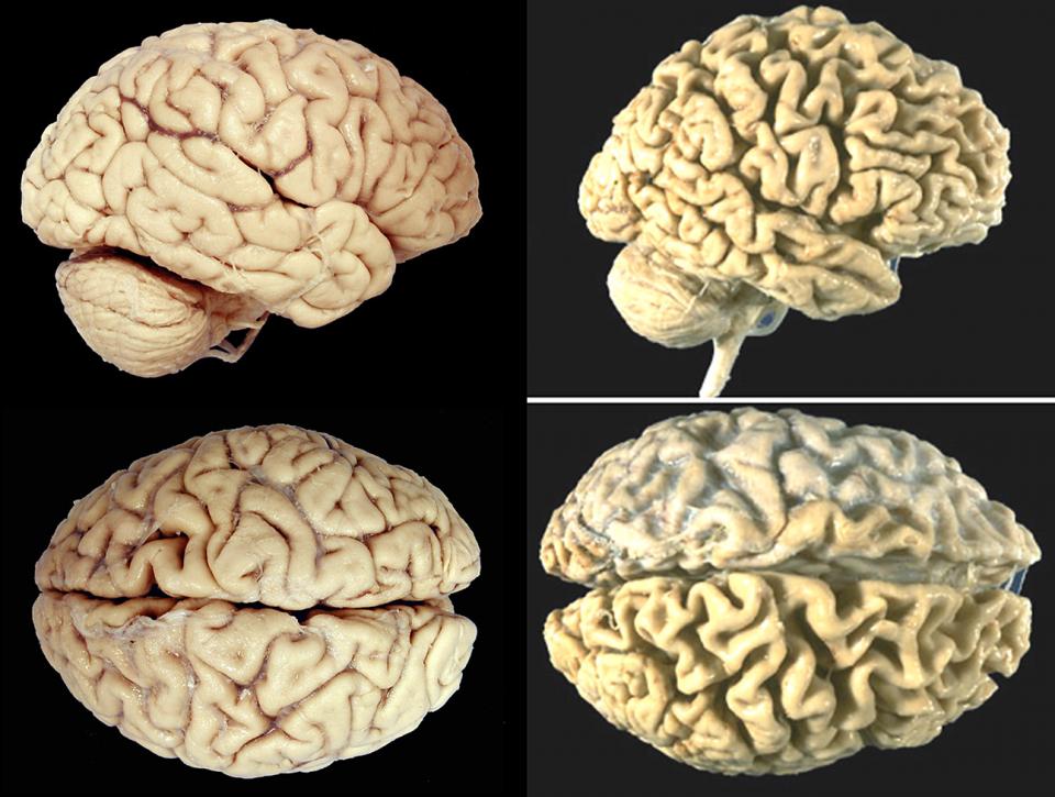 Картинки от старения мозга
